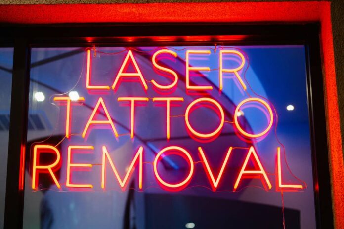 Tattoo remove